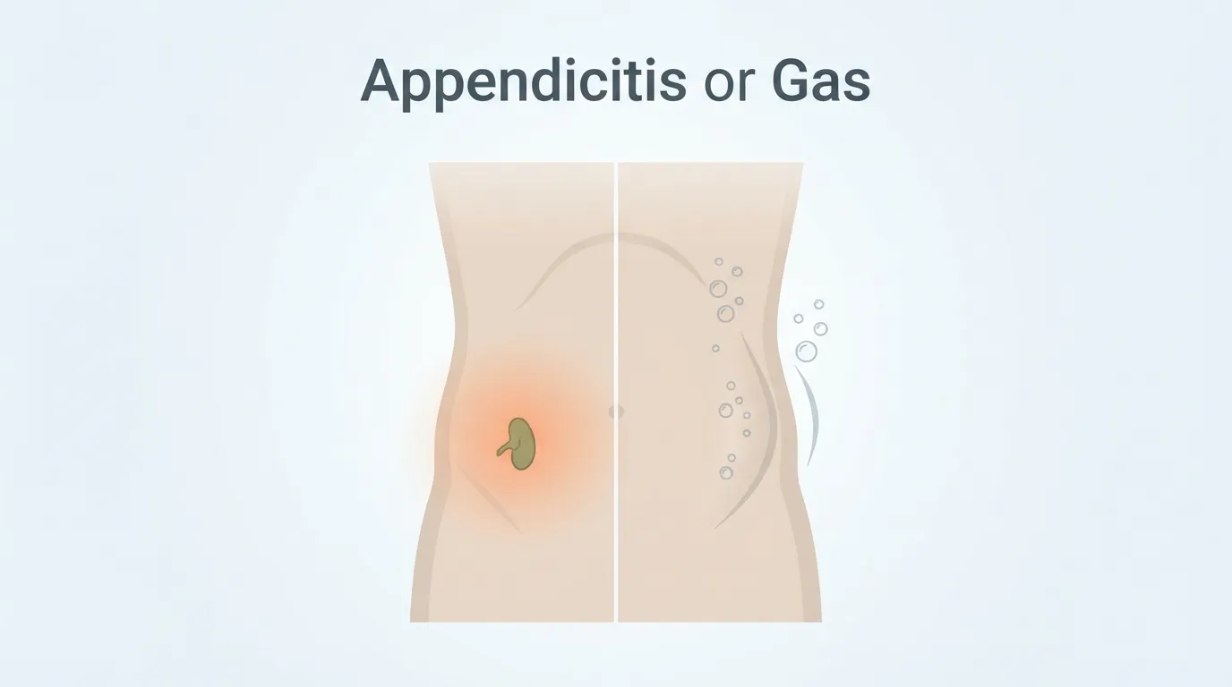 appendicitis or gas
